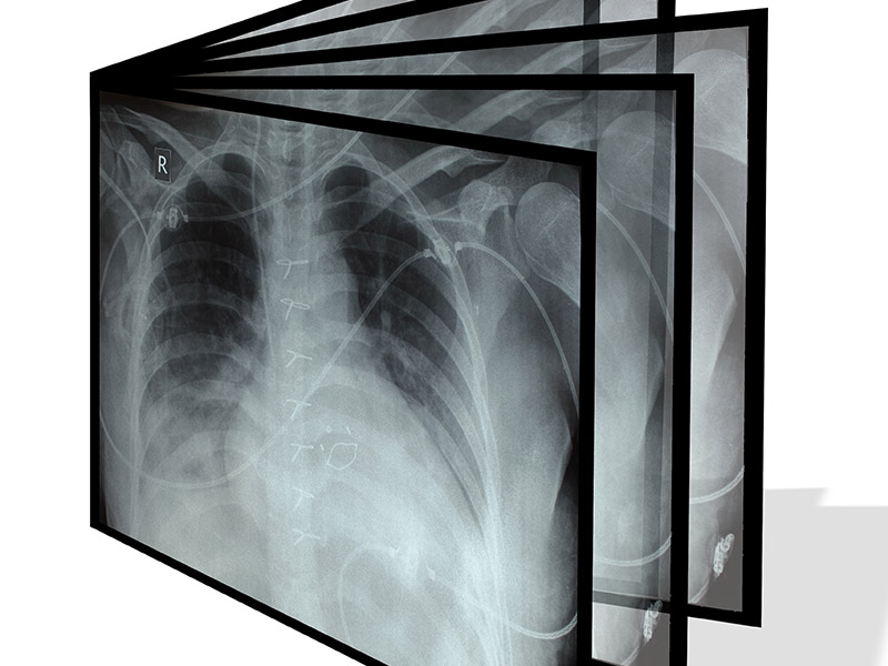 Collage an Röntgenbilder vor einem weißen Hintergrund.